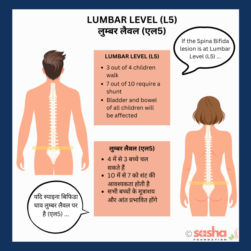 Lumbar-functional-level-l5