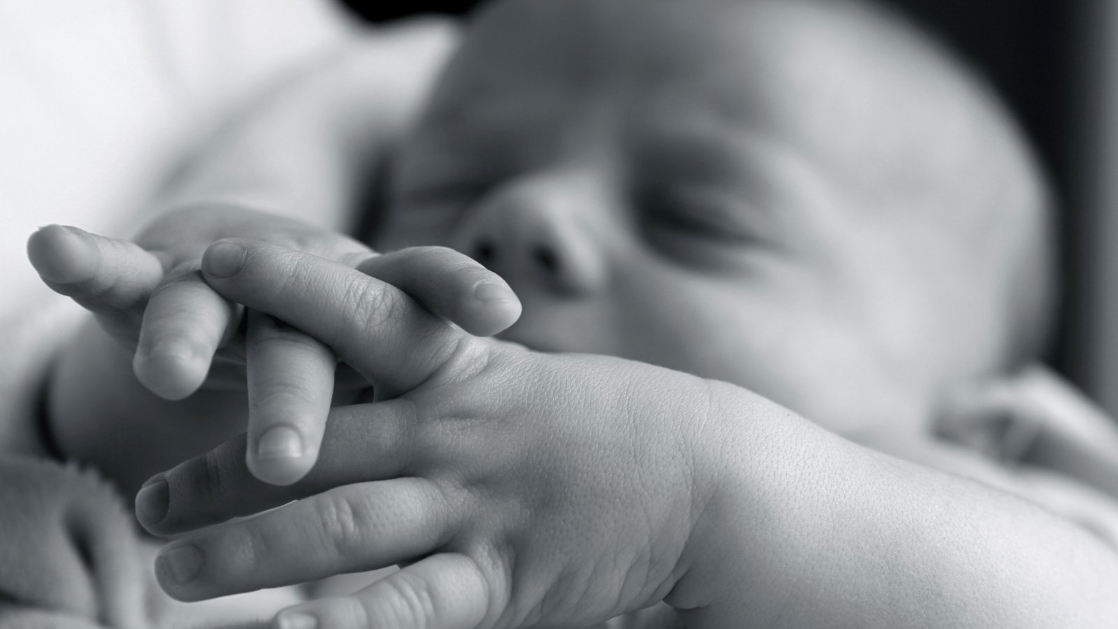 baby with spina bifida occulta, the leat complicated spine bifida